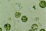 Isolation von Protoplasten